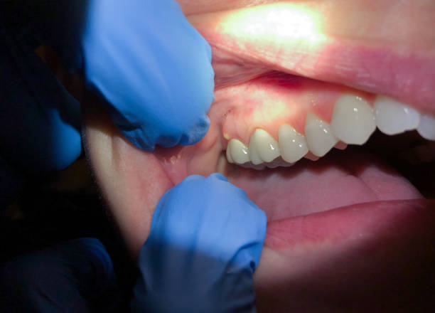 Best 24-Hour Dental Clinic Near Me  in Anderson Creek, NC